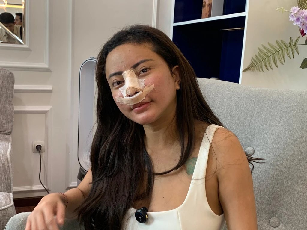 Ayu Aulia Kembali Oplas Hidung demi Proyek Film dan Eksis di Dunia Hiburan